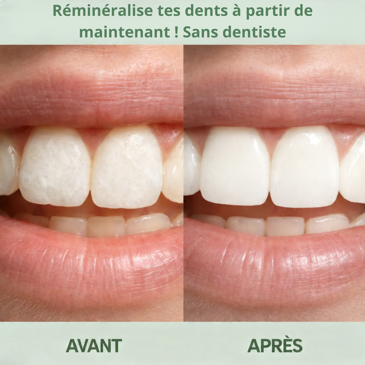 Le sourire sain et lumineux que tu mérites — enfin.